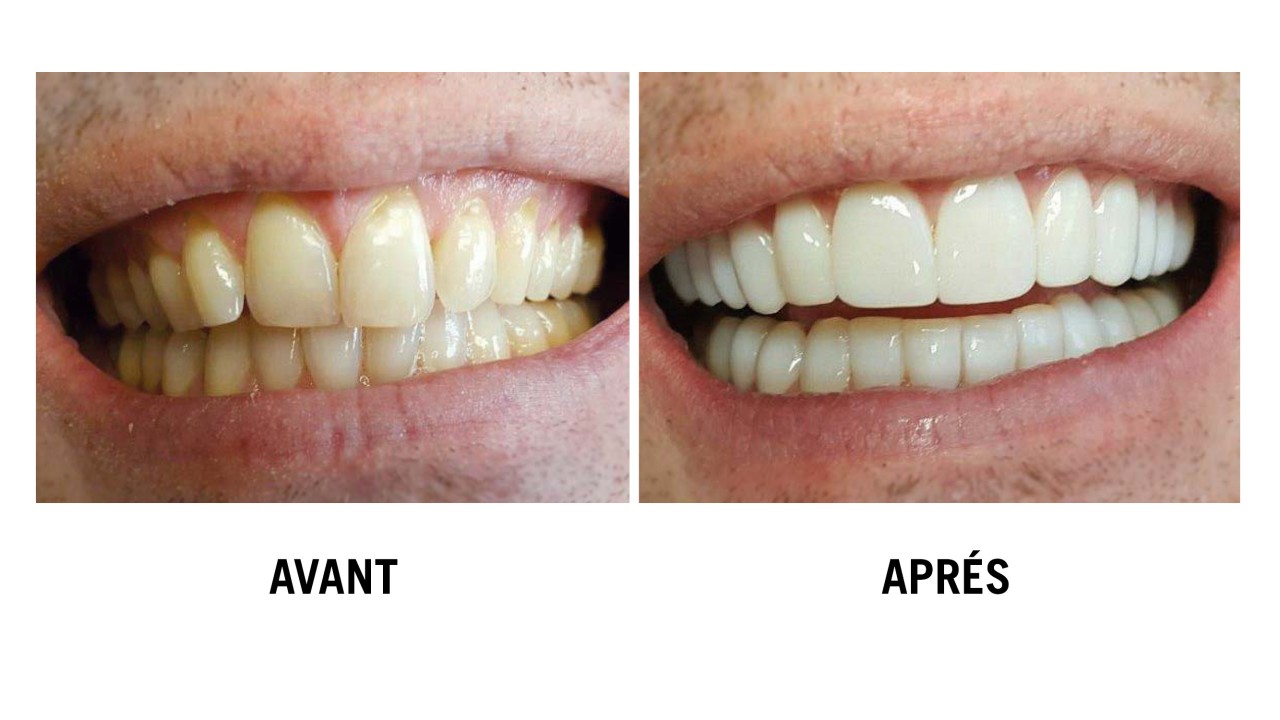 RestyleYourSmile
