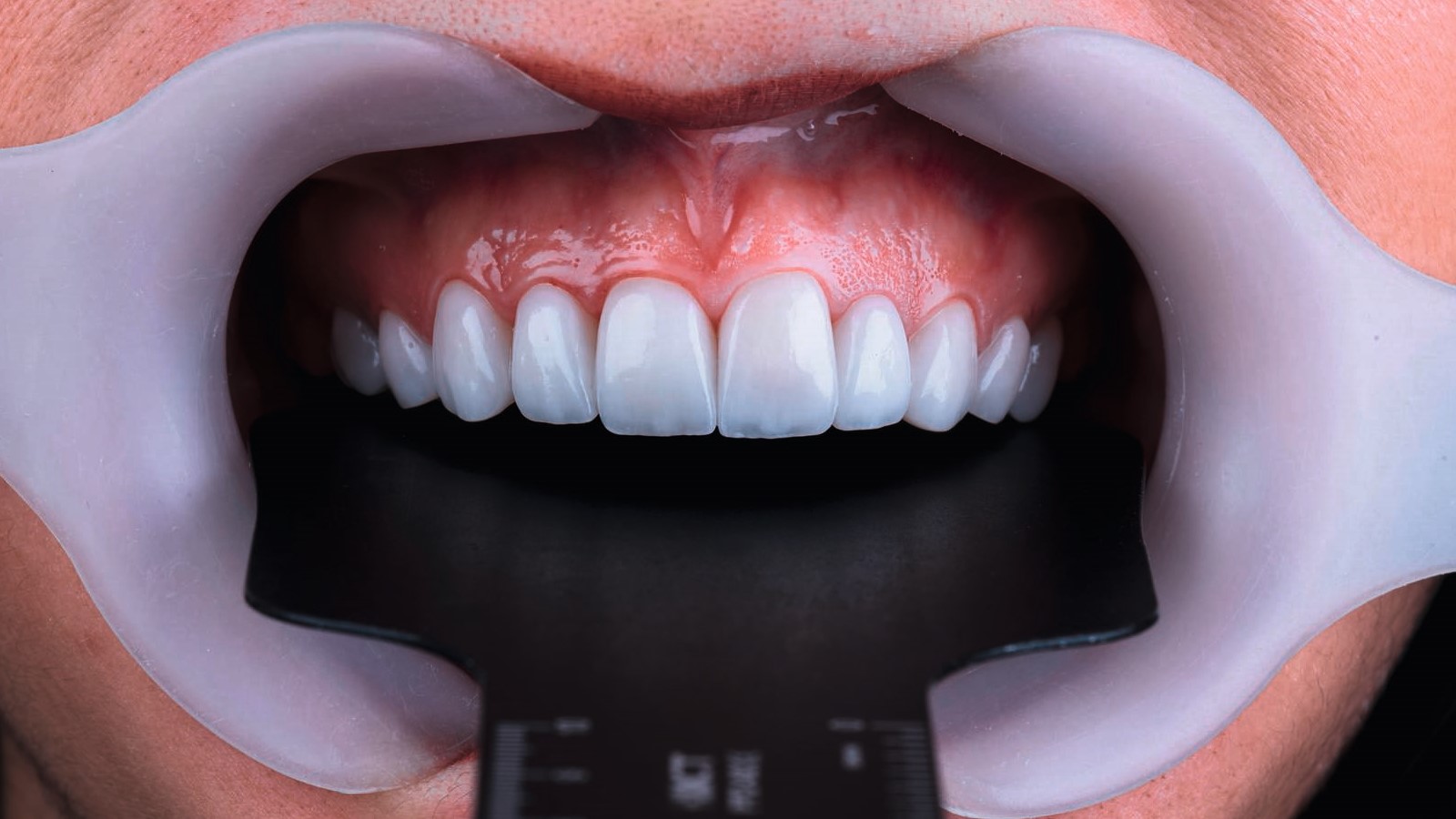 Conseils photographiques pour des résultats époustouflants