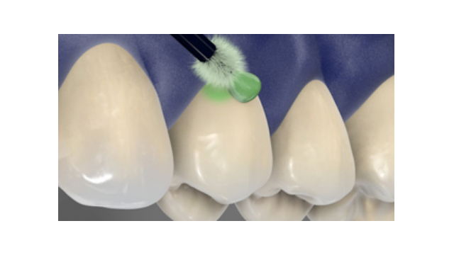 Produit désensibilisant