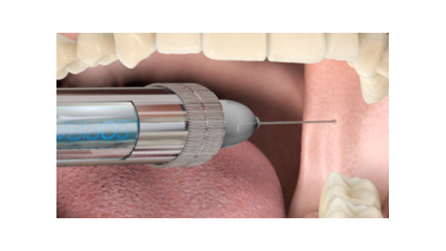 Anesthésie locale, intraseptale, tronculaire