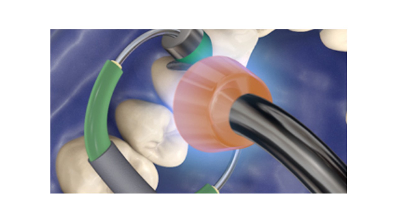 Lampes LED à polymériser