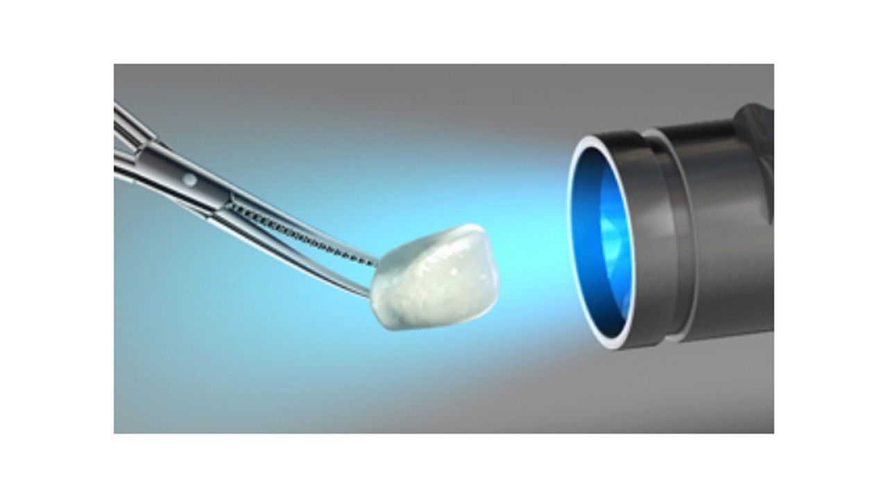 Appareils pour la polymérisation des composites