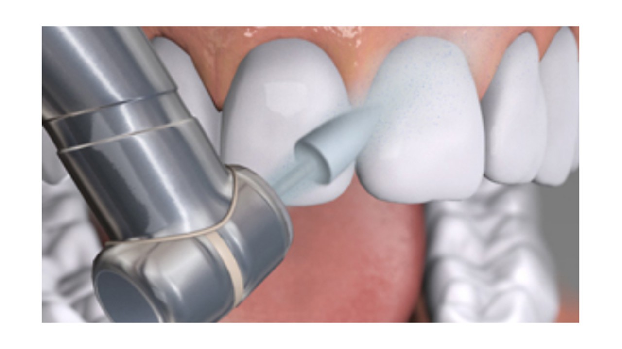 Dentisterie conservatrice