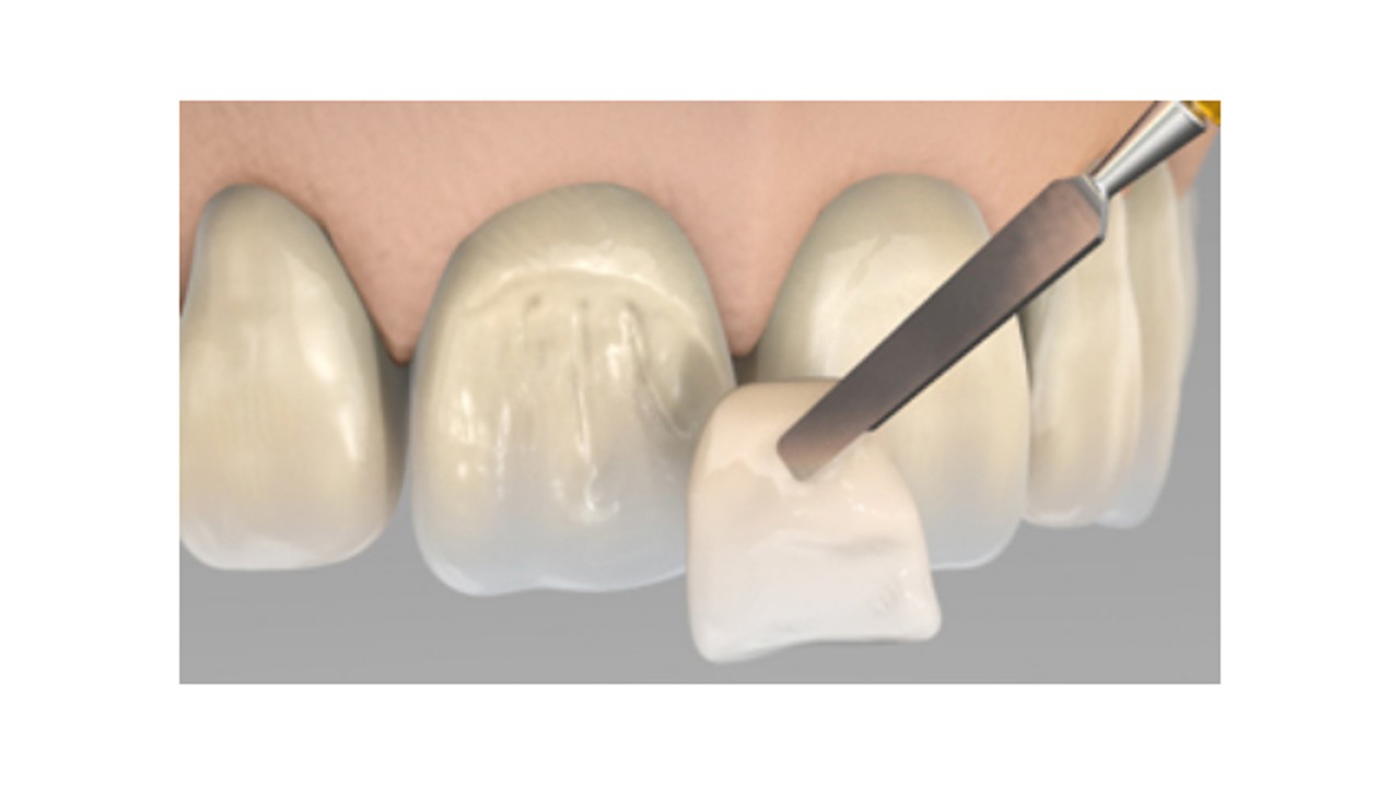 Composites de laboratoire
