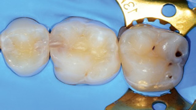 Venus case