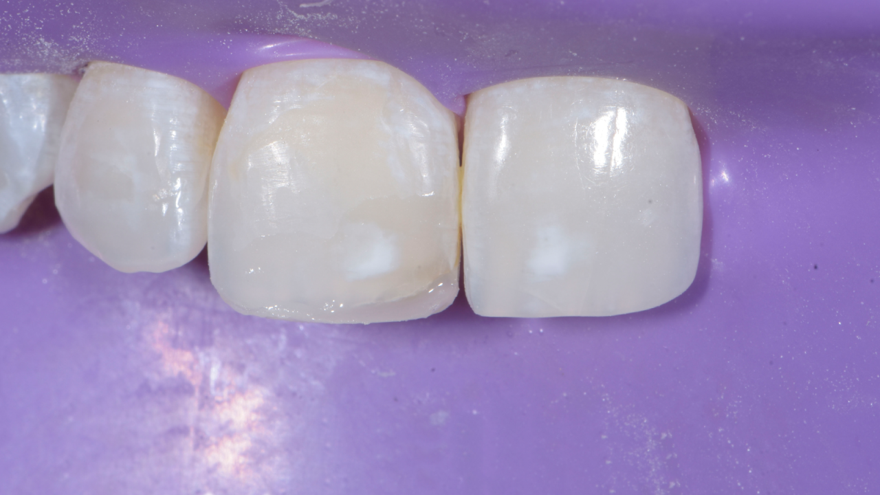 Première couche avec Venus Pearl LIGHT