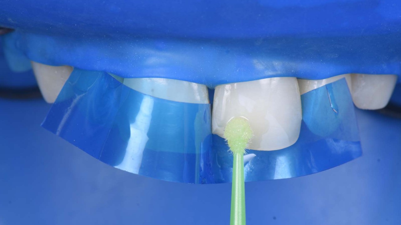 Applying iBOND Universal.